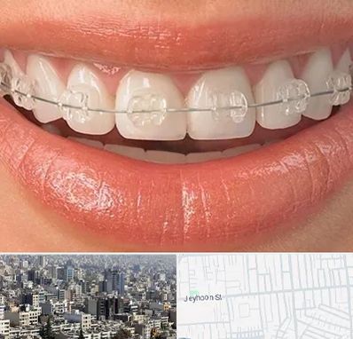 ارتودنسی اقساطی در جیحون