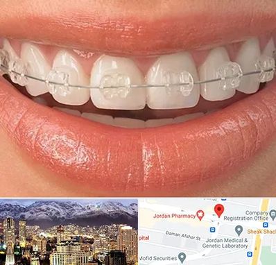 ارتودنسی اقساطی در جردن 