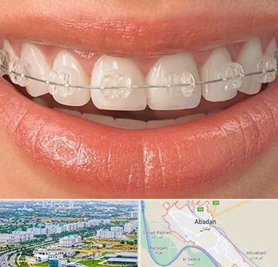 ارتودنسی اقساطی در آبادان