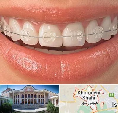 ارتودنسی اقساطی در خمینی شهر