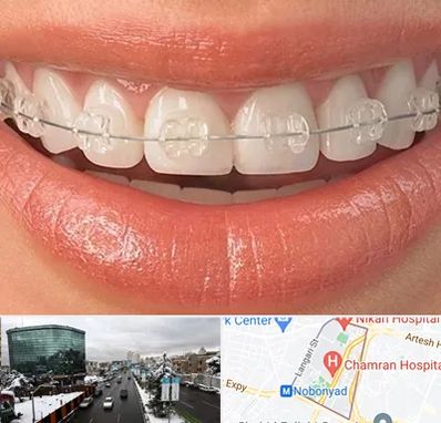 ارتودنسی اقساطی در اقدسیه 