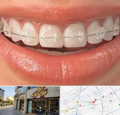 ارتودنسی اقساطی در عطاران قم