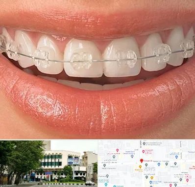 ارتودنسی اقساطی در طالقانی 