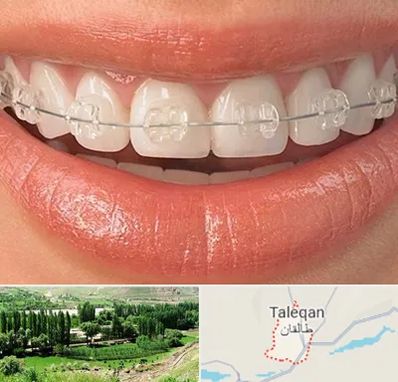 ارتودنسی اقساطی در طالقان