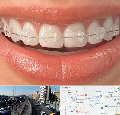 ارتودنسی اقساطی در پیروزی 