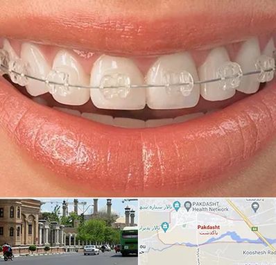ارتودنسی اقساطی در پاکدشت