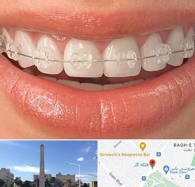 ارتودنسی اقساطی در فلکه گاز شیراز 