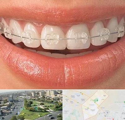 ارتودنسی اقساطی در کمال شهر کرج 