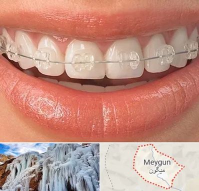 ارتودنسی اقساطی در میگون