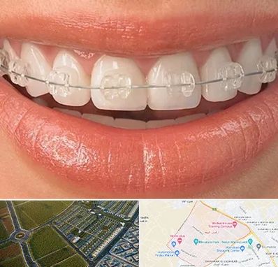 ارتودنسی اقساطی در الهیه مشهد 