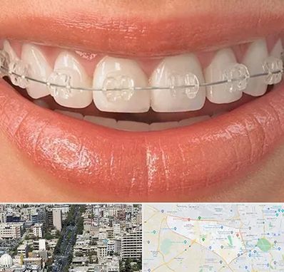 ارتودنسی اقساطی در منطقه 18 تهران 