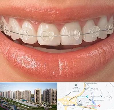 ارتودنسی اقساطی در المپیک 