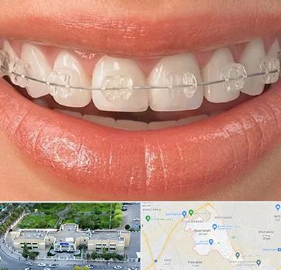 ارتودنسی اقساطی در نسیم شهر