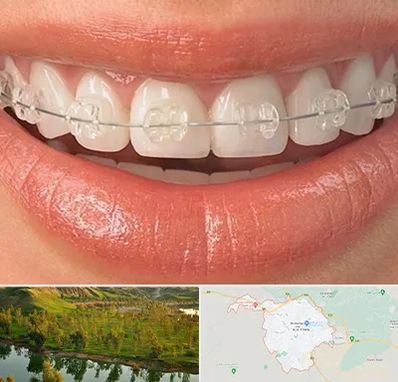 ارتودنسی اقساطی در بهبهان