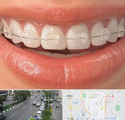 ارتودنسی اقساطی در ستارخان 