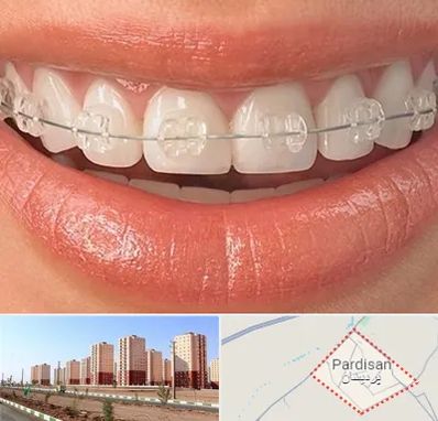 ارتودنسی اقساطی در پردیسان قم