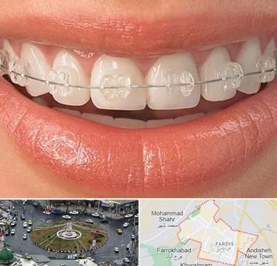 ارتودنسی اقساطی در فردیس کرج 