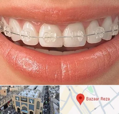 ارتودنسی اقساطی در بازار رضا مشهد