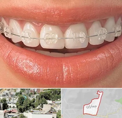 ارتودنسی اقساطی در جماران