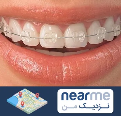 ارتودنسی اقساطی در نزدیک من