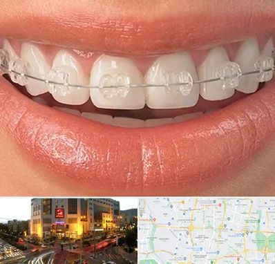 ارتودنسی اقساطی در جنت آباد تهران 