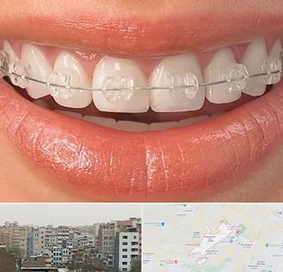 ارتودنسی اقساطی در محمد شهر کرج 