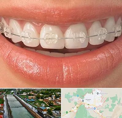 ارتودنسی اقساطی در مراغه