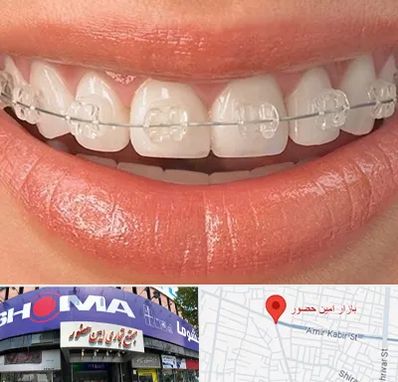 ارتودنسی اقساطی در امین حضور