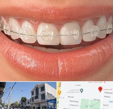 ارتودنسی اقساطی در افسریه 