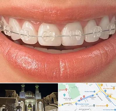 ارتودنسی اقساطی در زرگری شیراز 