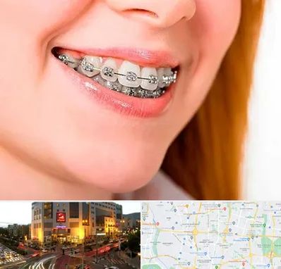 ارتودنسی ارزان در جنت آباد تهران 