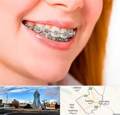 ارتودنسی ارزان در تایباد