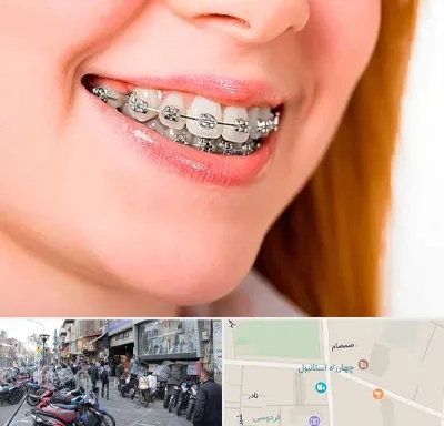 ارتودنسی ارزان در چهارراه استانبول