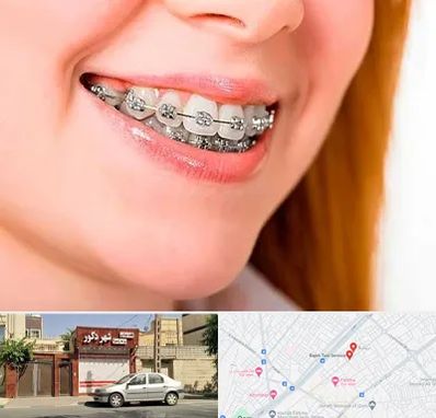 ارتودنسی ارزان در باجک قم