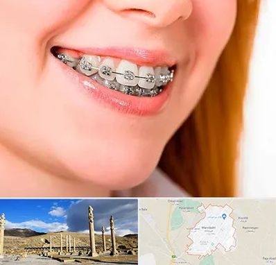 ارتودنسی ارزان در مرودشت