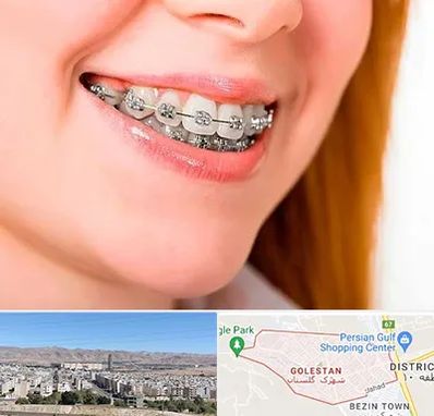 ارتودنسی ارزان در شهرک گلستان شیراز 