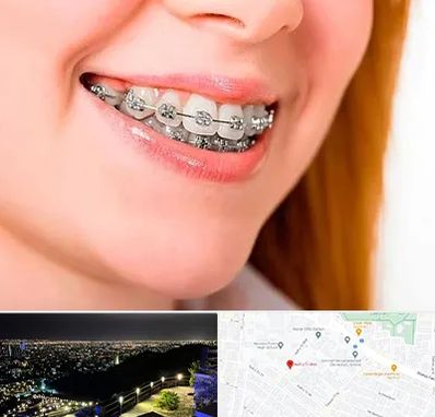 ارتودنسی ارزان در هفت تیر مشهد 