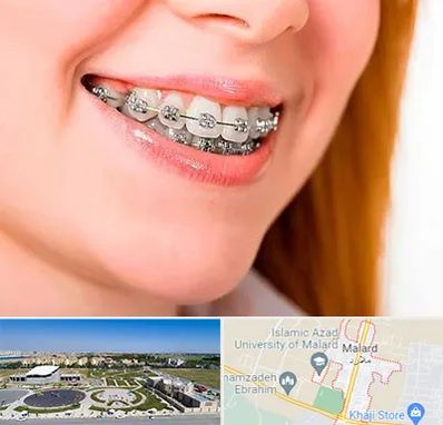 ارتودنسی ارزان در ملارد