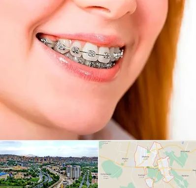 ارتودنسی ارزان در شهریار