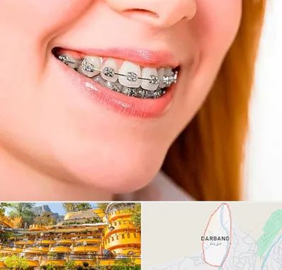 ارتودنسی ارزان در دربند