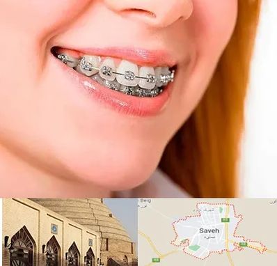 ارتودنسی ارزان در ساوه