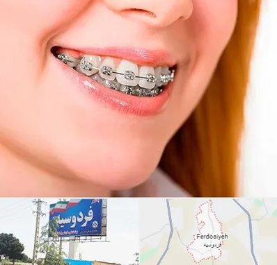 ارتودنسی ارزان در فردوسیه شهریار