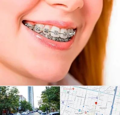 ارتودنسی ارزان در امامت مشهد 