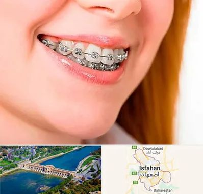 ارتودنسی ارزان در اصفهان