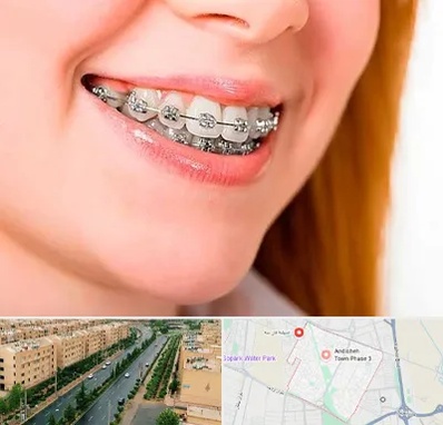 ارتودنسی ارزان در فاز سه اندیشه