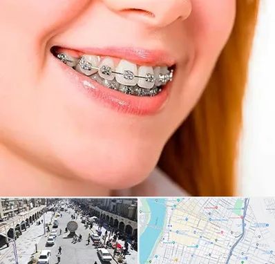 ارتودنسی ارزان در نادری اهواز 