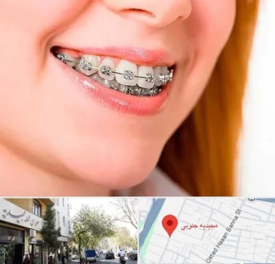 ارتودنسی ارزان در مجیدیه جنوبی