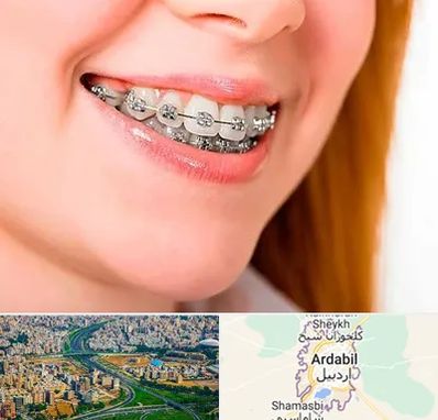 ارتودنسی ارزان در اردبیل