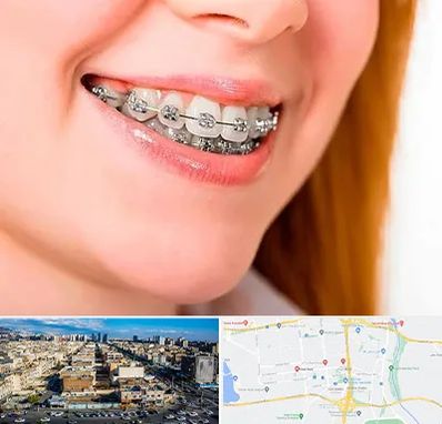 ارتودنسی ارزان در شهرک راه آهن 