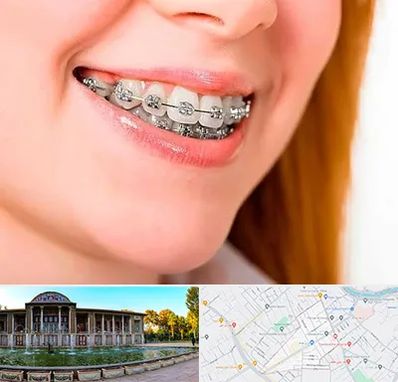 ارتودنسی ارزان در عفیف آباد شیراز 